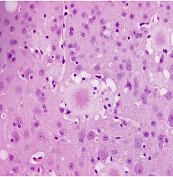 Une illustration des prions dans un dossier de recherche de l'INRA (ph INRA)